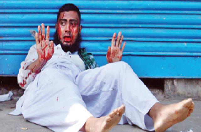 শাপলা চত্বরে আহত মুসলমান