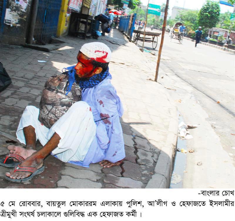 বেচে থেকেও গভীর ক্ষতের যন্ত্রনা ভোগ করছেন